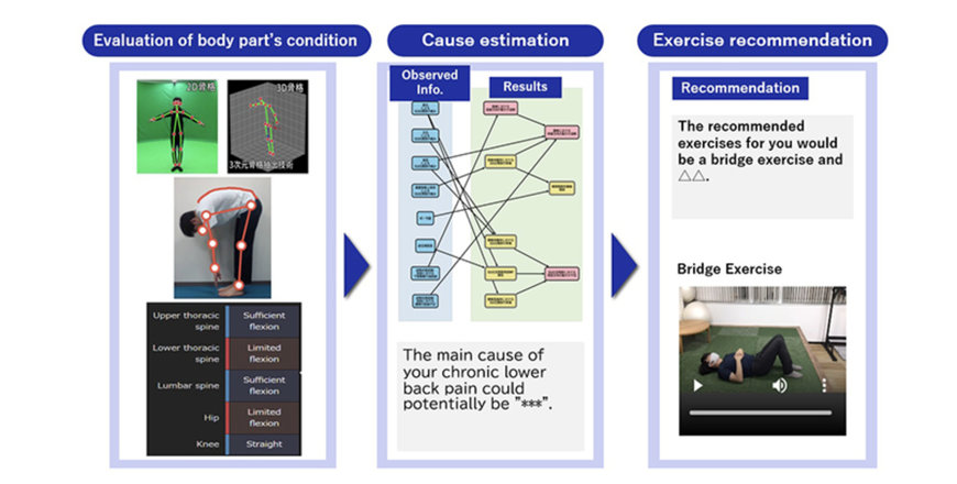 NEC and Tokyo Medical and Dental University use AI to assist self-care for chronic lower back pain